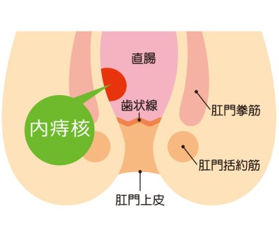 小学生　肛門 